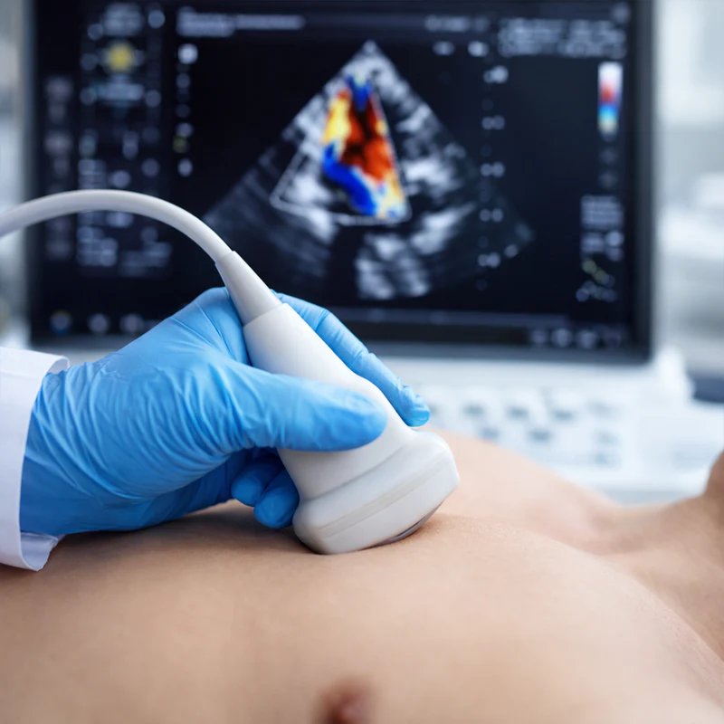 Echocardiography